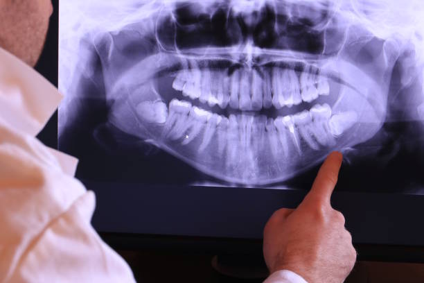 Best Emergency Dental Care for Broken or Chipped Teeth in Lathrop, CA